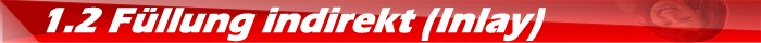 1.2 Füllung indirekt im Labor